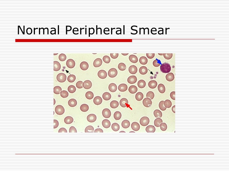 Normal Peripheral Smear